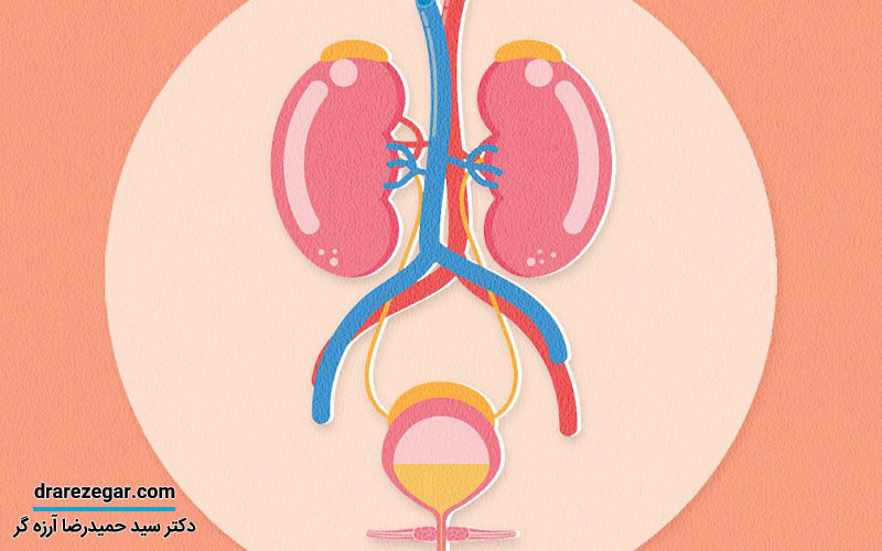 سندرم مثانه دردناک