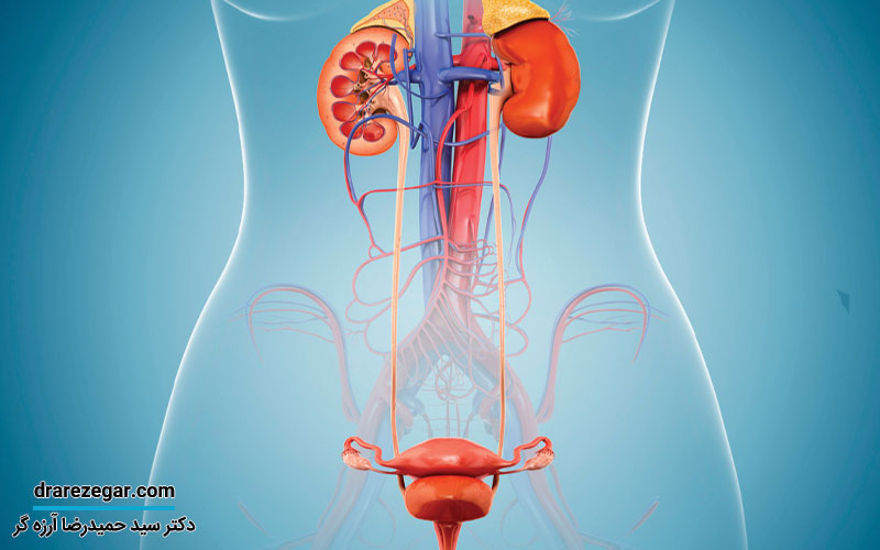درباره مثانه نوروژنیک باید بدانید