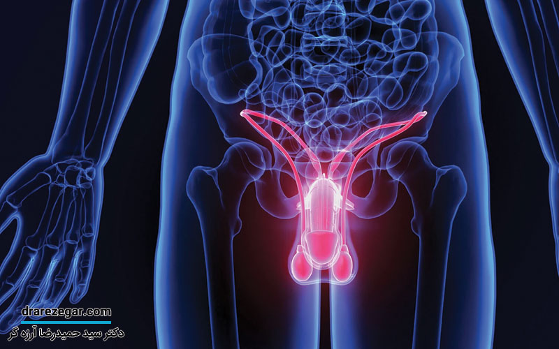 درمان های پیشرفته اختلال نعوظ