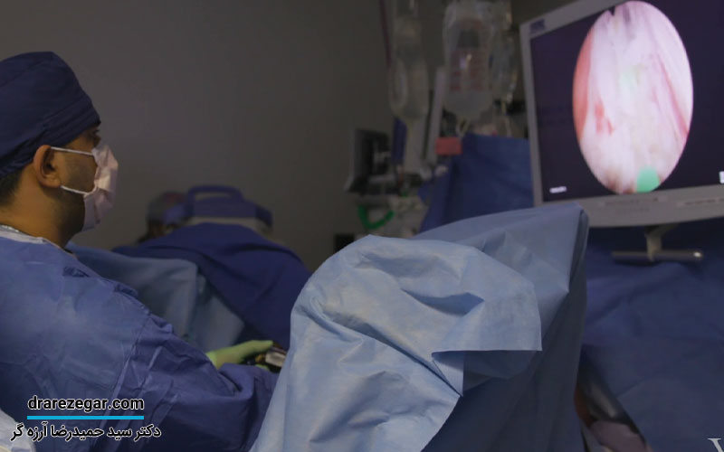 علت خونریزی بعد از جراحی پروستات