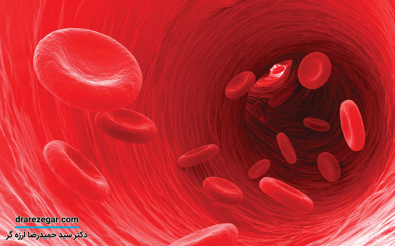 علت خونریزی بعد از جراحی پروستات