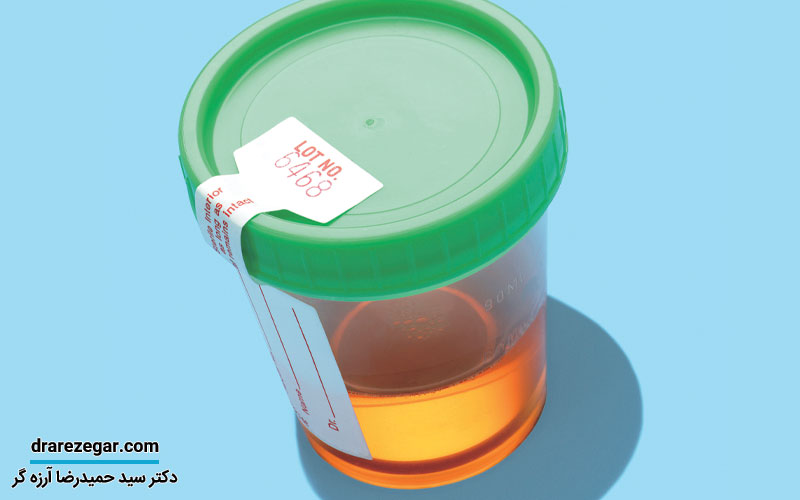 علت وجود خون در ادرار کودکان