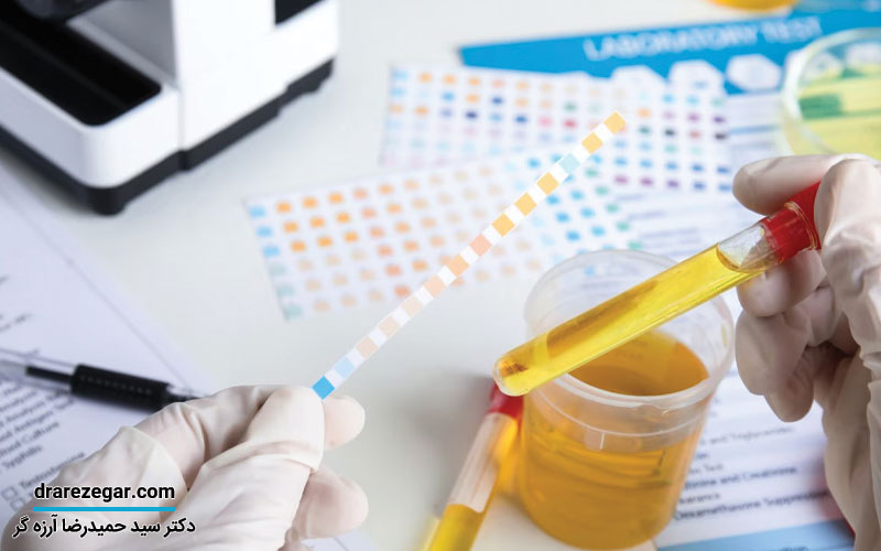 علت وجود خون در ادرار کودکان