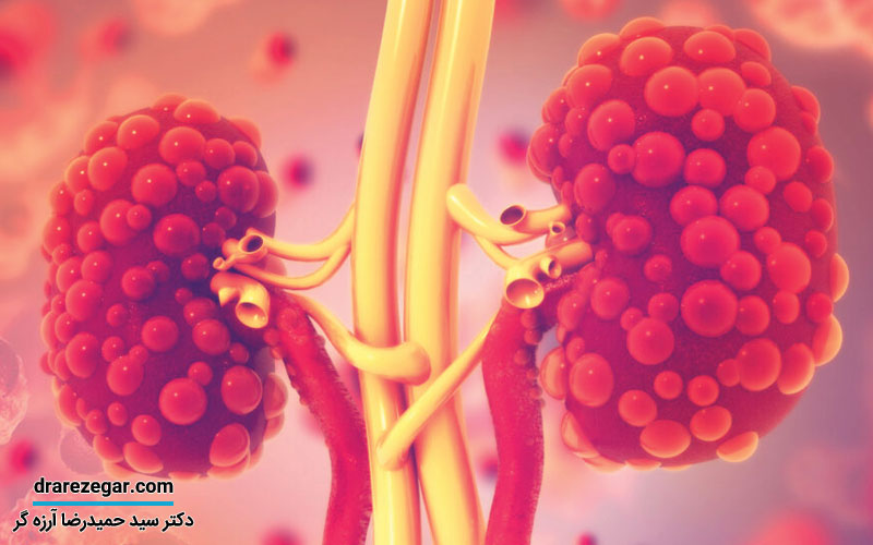 ناهنجاری های مادرزادی کلیه ها