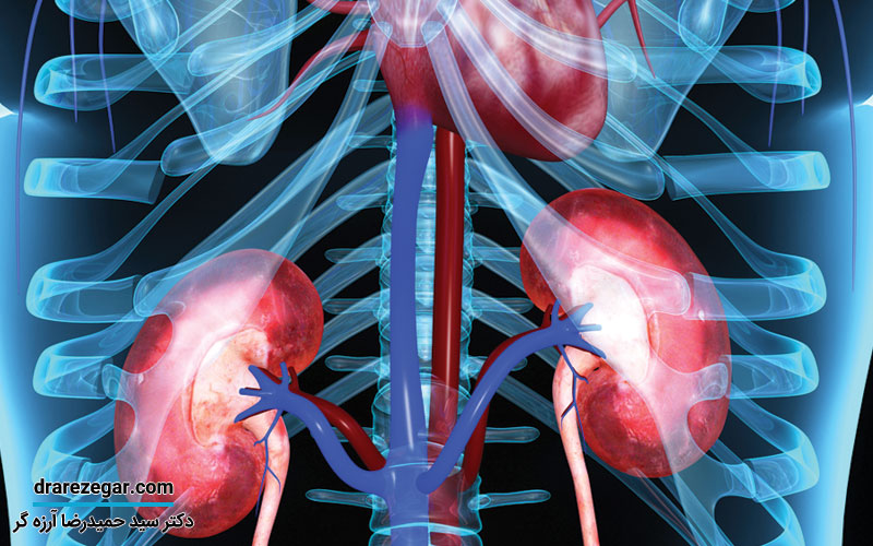 ناهنجاری های مادرزادی کلیه ها
