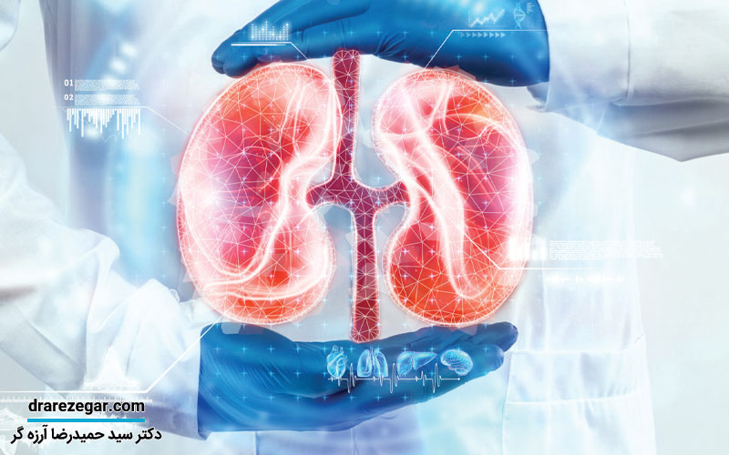 مراقبت های پس از جراحی سنگ کلیه در حالب