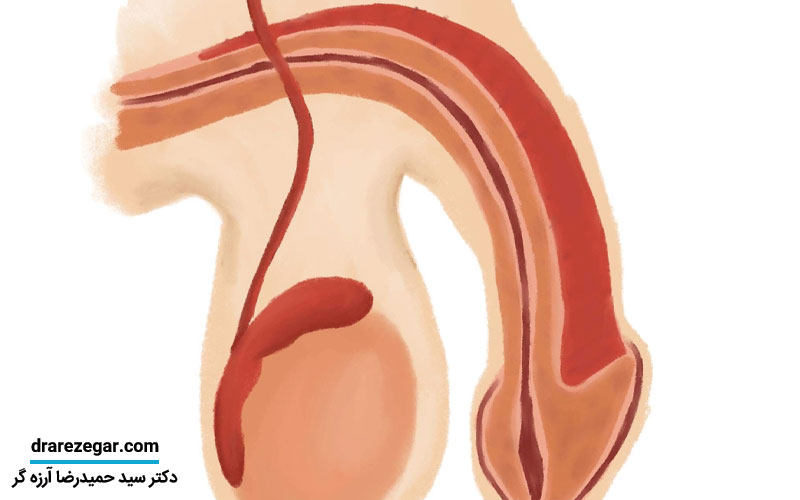 درمان های غیرجراحی برای اختلال نعوظ