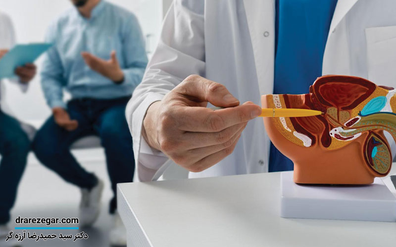 بهترین کاندیدا برای پروستاتکتومی