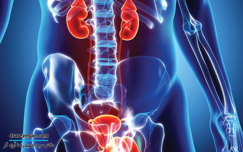 دیابت و مشکلات اورولوژیک در مردان