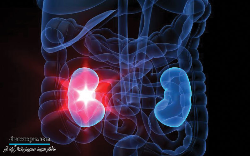 تفاوت بین سنگ کلیه و عفونت ادراری