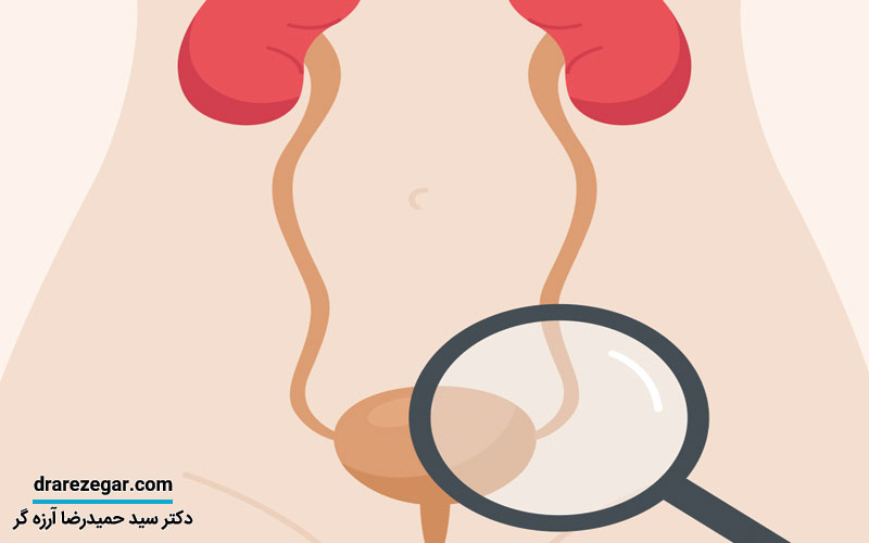 عفونت های مجاری ادراری (UTI) در مردان