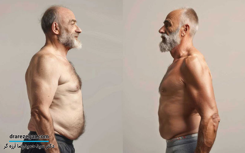 استفاده از تستوسترون تراپی برای درمان اختلالات جنسی