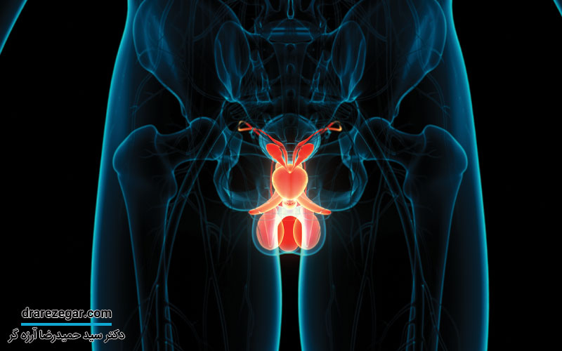 دلایل درد بیضه ها بدون وجود بیماری