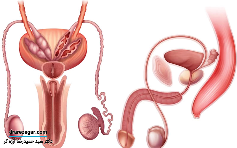 آیا واریکوسل بر کیفیت اسپرم تاثیر می گذارد