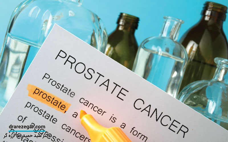 پیشگیری از سرطان پروستات
