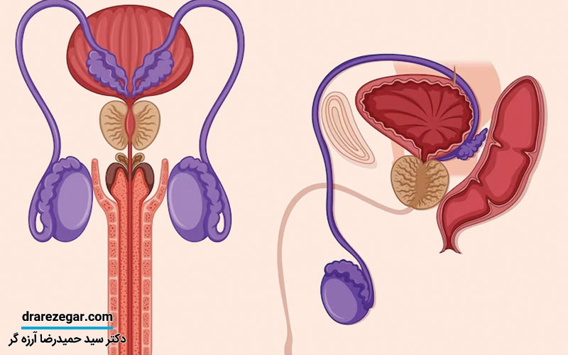 پیشگیری از سرطان پروستات