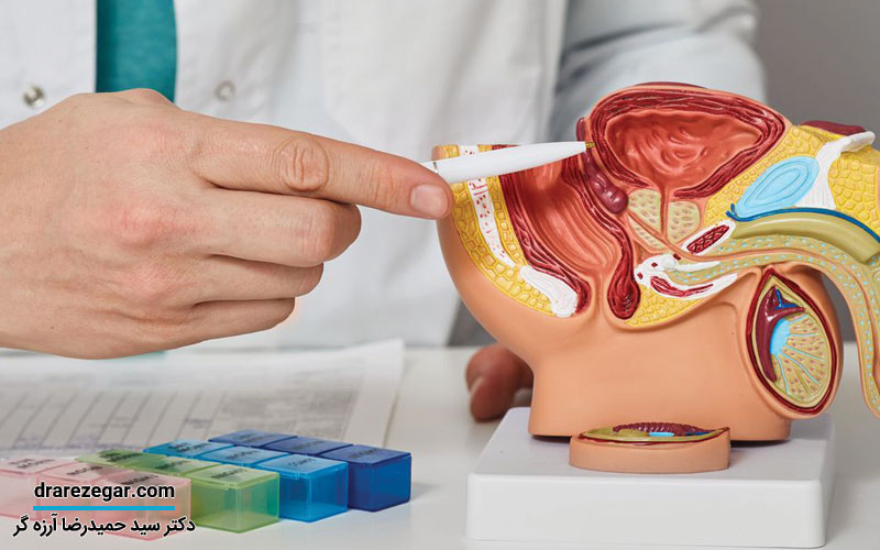 تاثیر مشکلات اورولوژیک در ناباروری