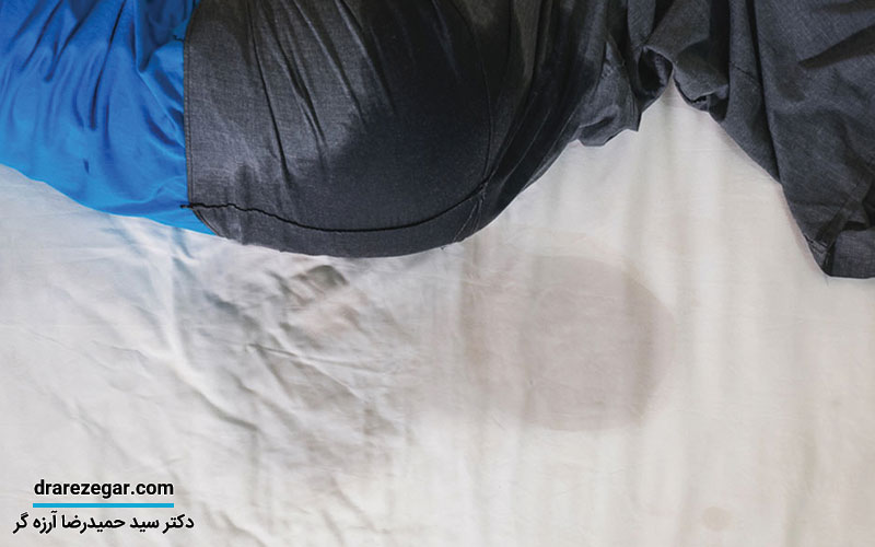 روش درمان شب ادراری در بزرگسالان