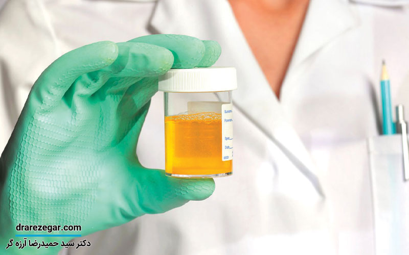 علت تغییر رنگ ادرار چیست