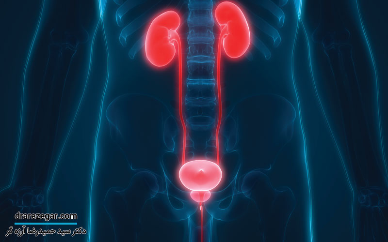 افتادگی مثانه در مردان