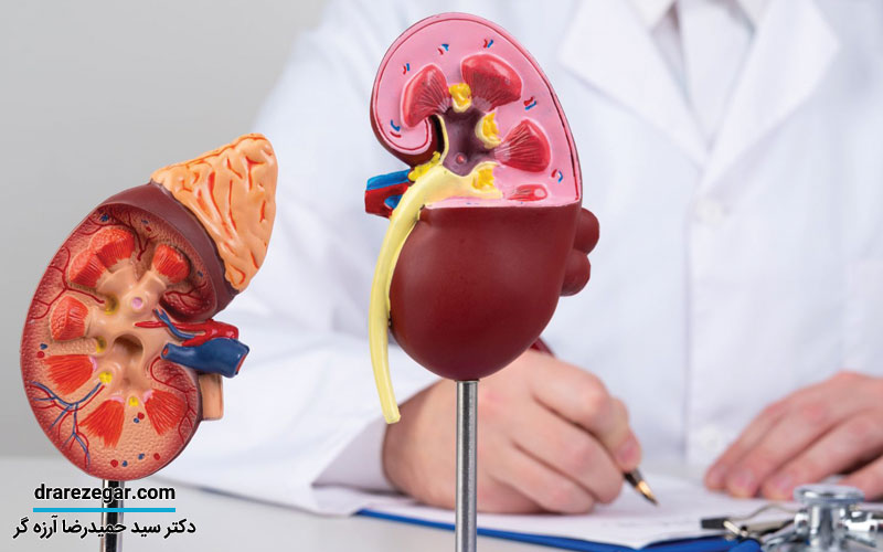 عوارض عدم درمان کیست کلیه