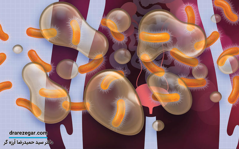 تفاوت عفونت ادراری با عفونت جنسی در مردان