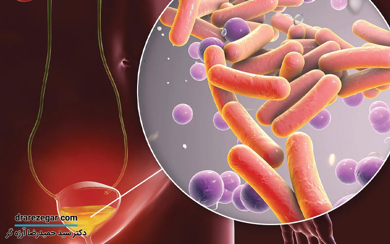 تفاوت عفونت ادراری با عفونت جنسی