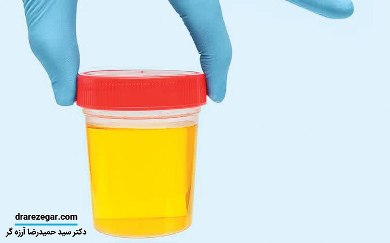 تفاوت عفونت ادراری با عفونت جنسی