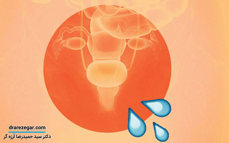 درمان نشت ادرار بعد از رابطه جنسی