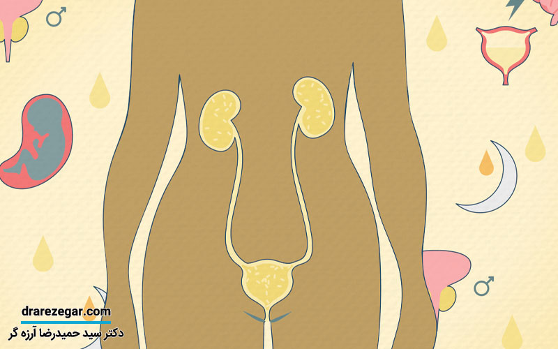 اختلالات ادراری در بیماران مبتلا به ام اس