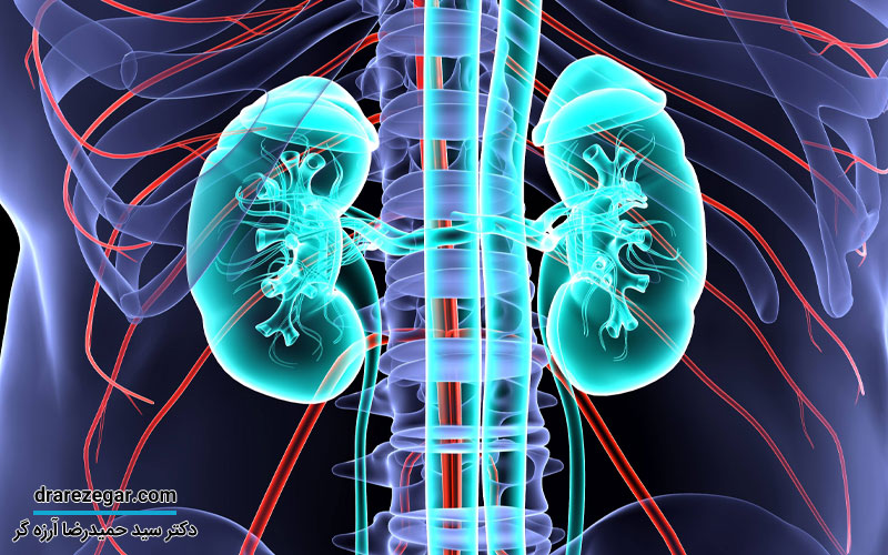 جراحی برداشتن کیست کلیه