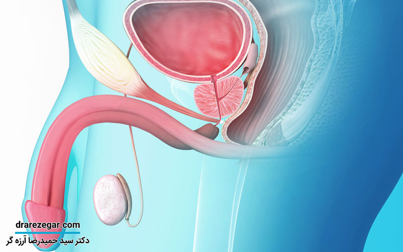 انسداد مجرای ادرار در مردان