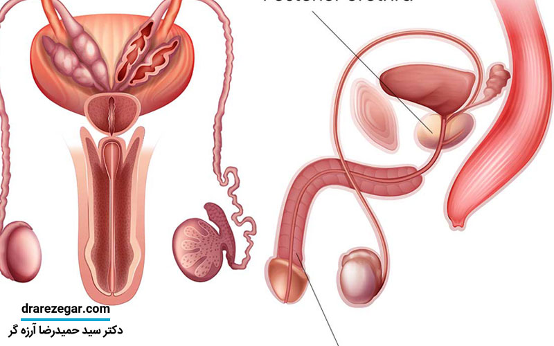 علائم هشداردهنده تنگی مجرای ادراری