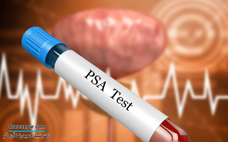 آزمایش PSA چیست