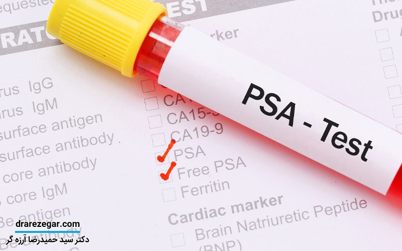 آزمایش PSA چیست