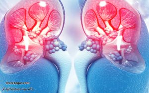 لخته شدن خون در وریدهای کلیوی