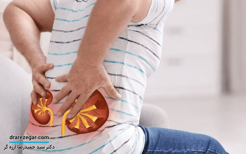 علائم گوارشی سنگ کلیه