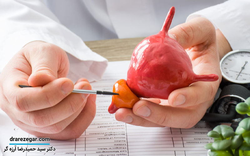 بی‌اختیاری ادرار بعد از جراحی پروستات