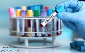 عوامل بالا رفتن PSA