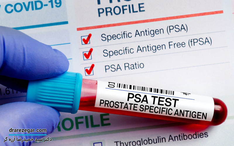 عوامل بالا رفتن PSA