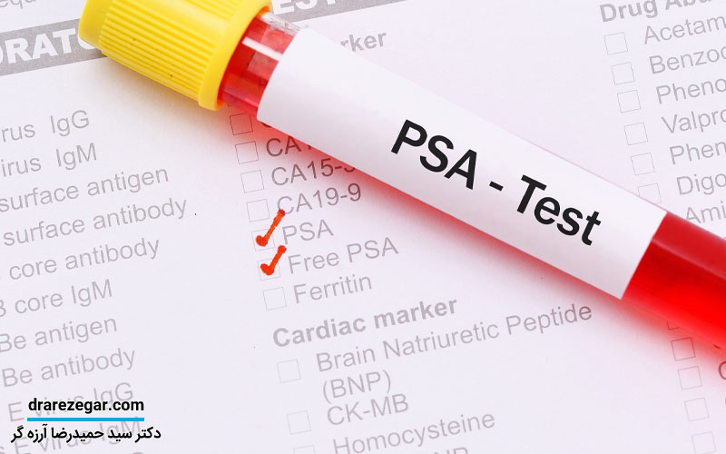 عوامل بالا رفتن PSA