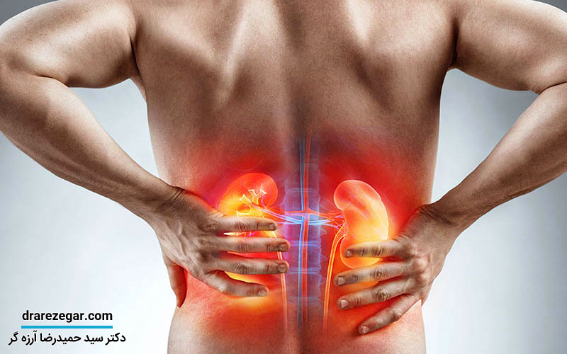 علت درد بعد از دفع سنگ کلیه چیست